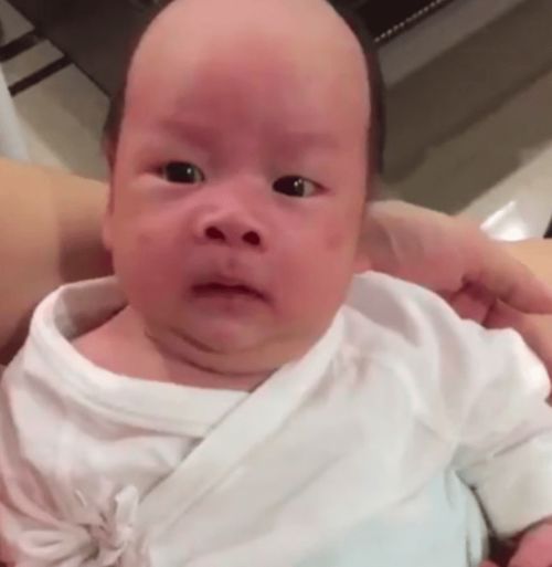 吃秋水仙碱腹泻怎么办 吃秋水仙碱腹泻怎么办