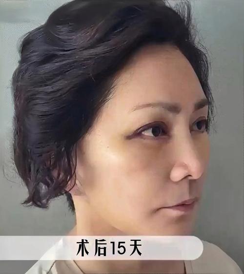 肚子疼吃打胎药有影响吗