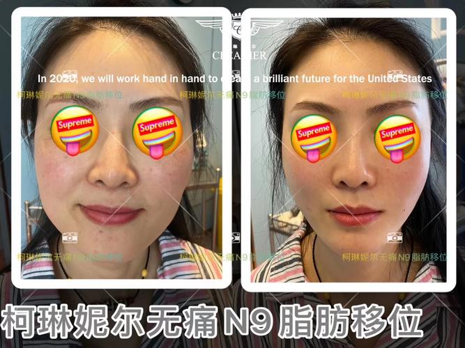 兄弟女友打胎文案短句 兄弟女友打胎文案短句