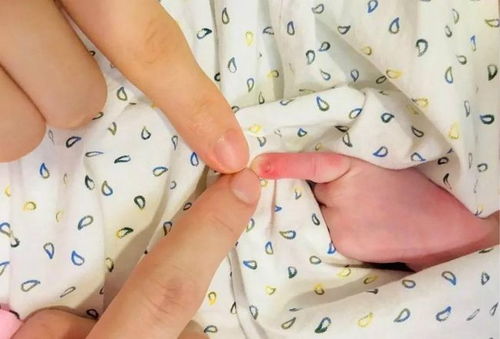 民权妇幼保健院打胎价格 民权妇幼保健院打胎价格