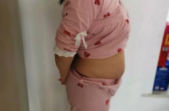 头痛眼睛痛怎么回事 头痛眼睛痛怎么回事