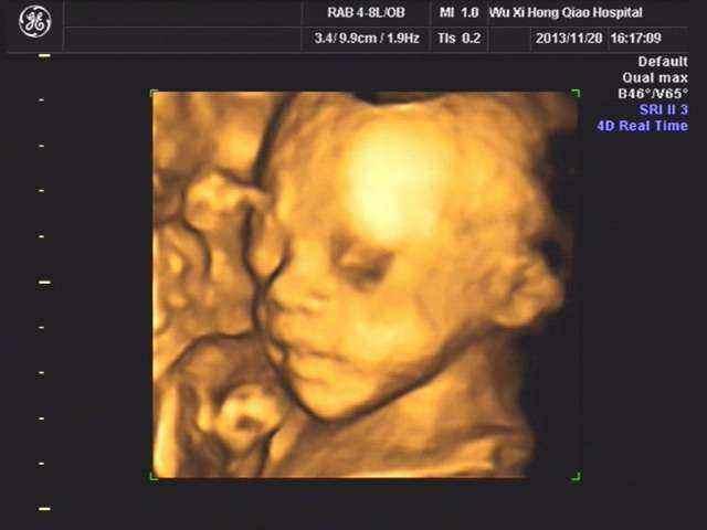 打胎了离婚会赔偿吗 打胎离婚女人什么心态 打胎了离婚会赔偿吗 打胎离婚女人什么心态