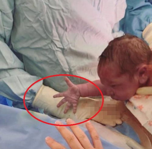 多久做打胎手术_多久做打胎手术合适 多久做打胎手术_多久做打胎手术合适