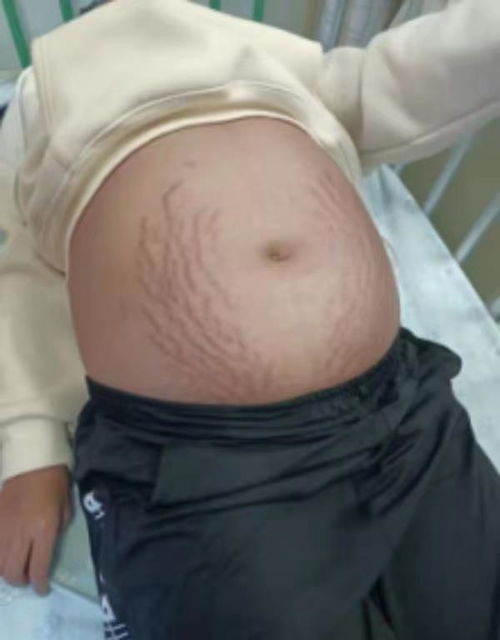 伊宁怀孕多久可以打胎