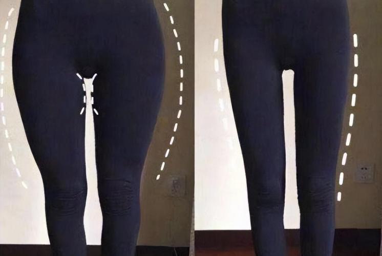 苏州打胎费用盛誉东吴