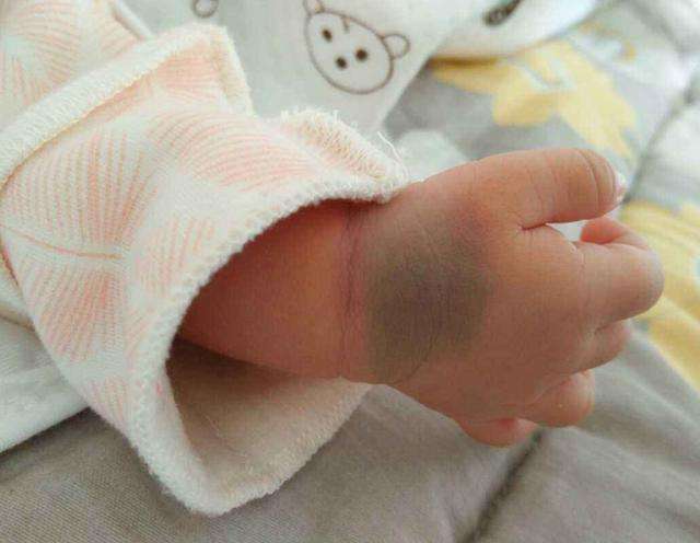 梦到亲戚怀孕帮忙打胎 梦到亲戚怀孕帮忙打胎