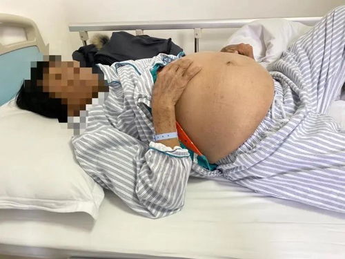 怀孕一个月打胎能打胎 怀孕一个月打胎能打胎