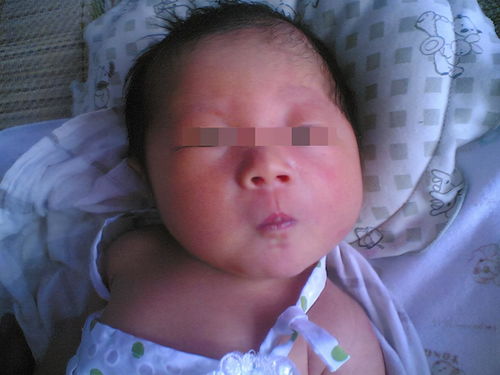 网上在线咨询打胎免费