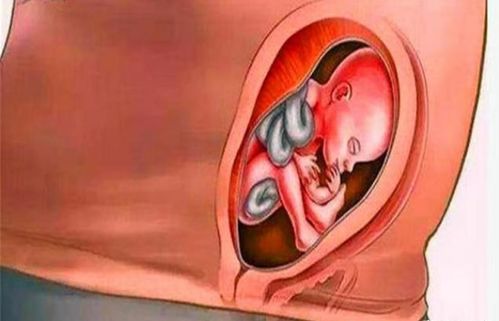 感冒打胎多少钱 感冒打胎多少钱一次