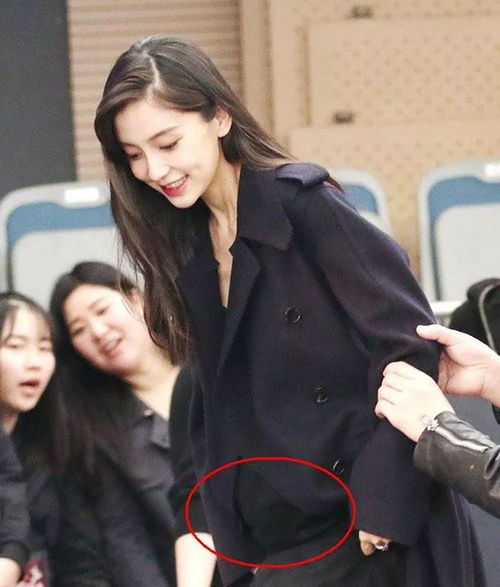 如何改善过敏体质