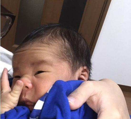 硫酸锌尿囊素滴眼液