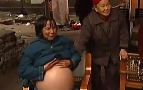 临沂无痛打胎得多少钱啊