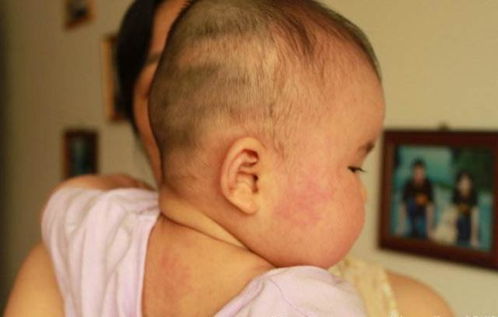 已婚打胎需要男_已婚打胎需要男方赔偿吗