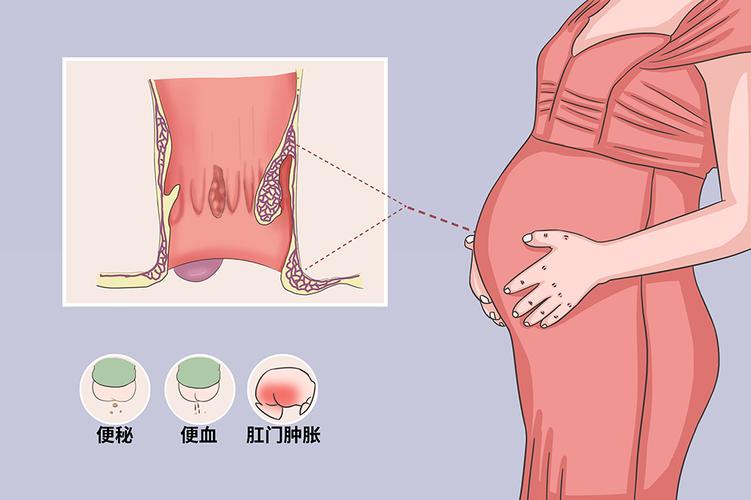 刘涛结婚照 刘涛结婚视频刘