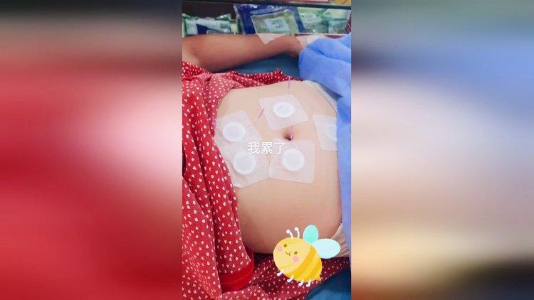 女生打胎痕迹_女生打胎过有什么特征