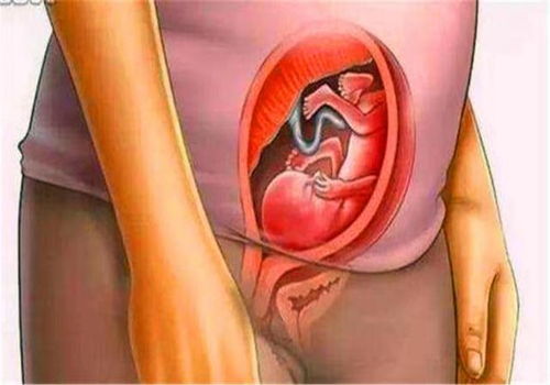 第二次打胎的影响大不大