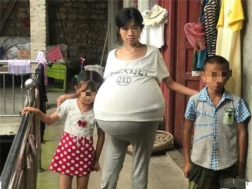 演员李昊石 李昊现状