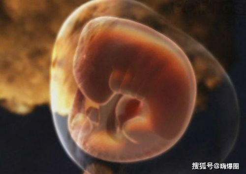 厦门打胎费用认同天济