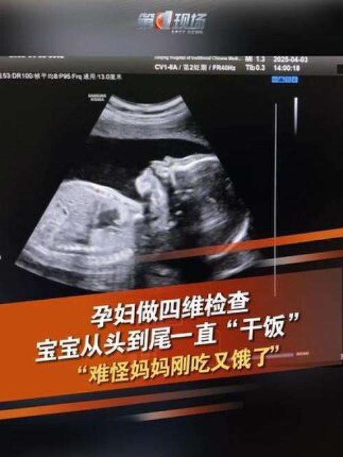 三个月以后打胎会痛吗