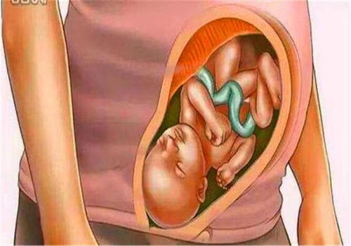 沈阳打胎那个医院较好